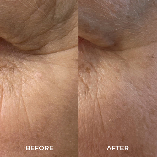 wonder eye cream before and after comparison