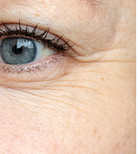 image close up of fine lines, wrinkles